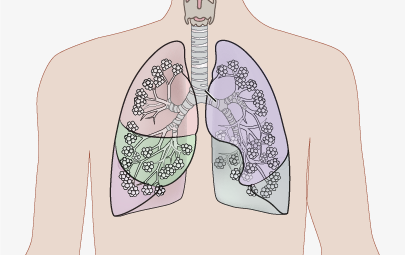 Lungs
