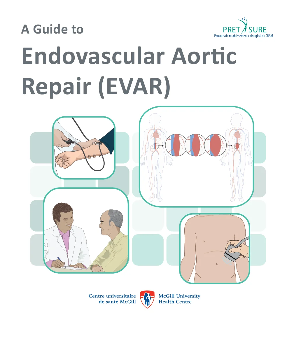 Endovascular Aortic Repair