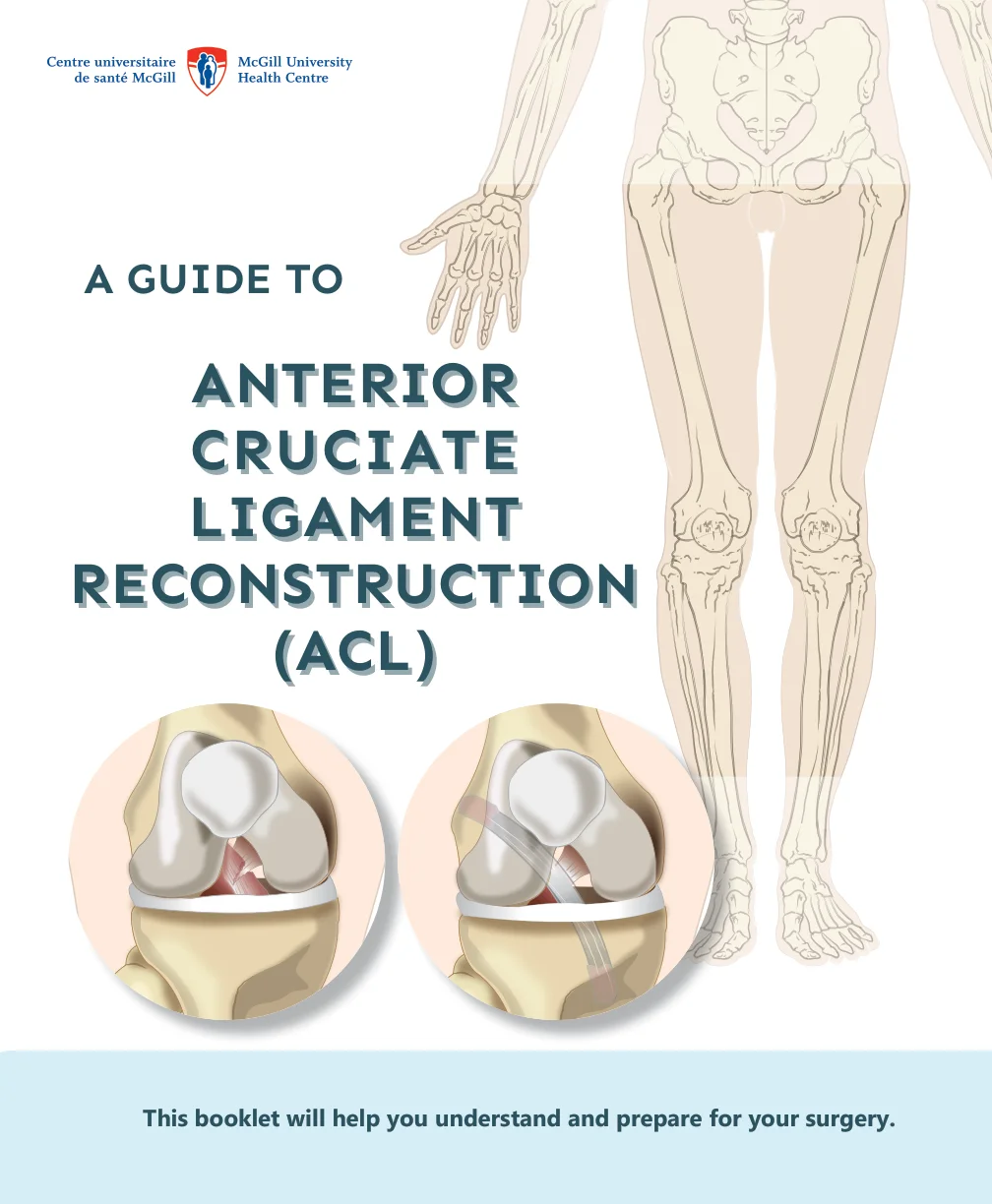 A guide to anterior cruciate ligament surgery