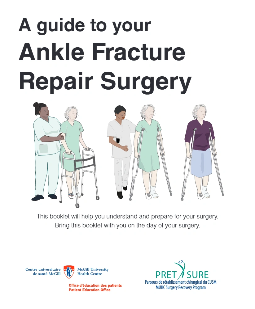 A Guide to your Ankle Fracture Repair Surgery
