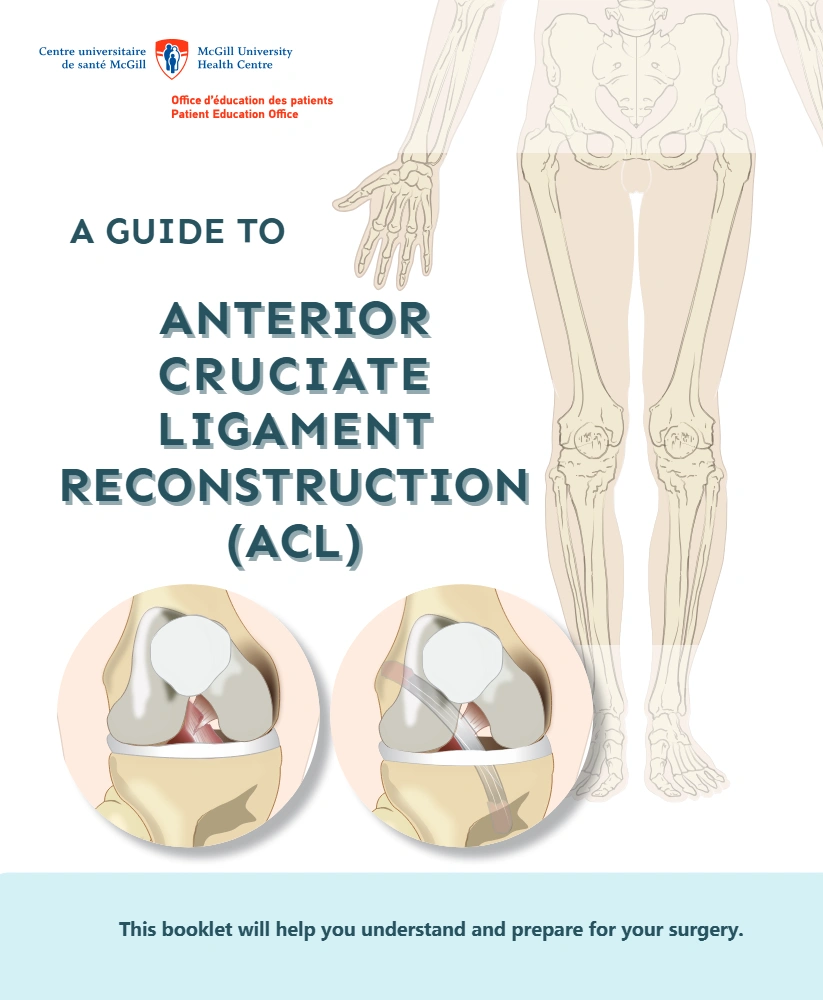A guide to anterior cruciate ligament surgery