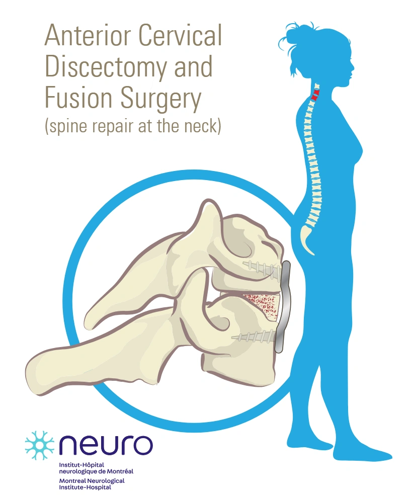 Anterior cervical discectomy and fusion surgery