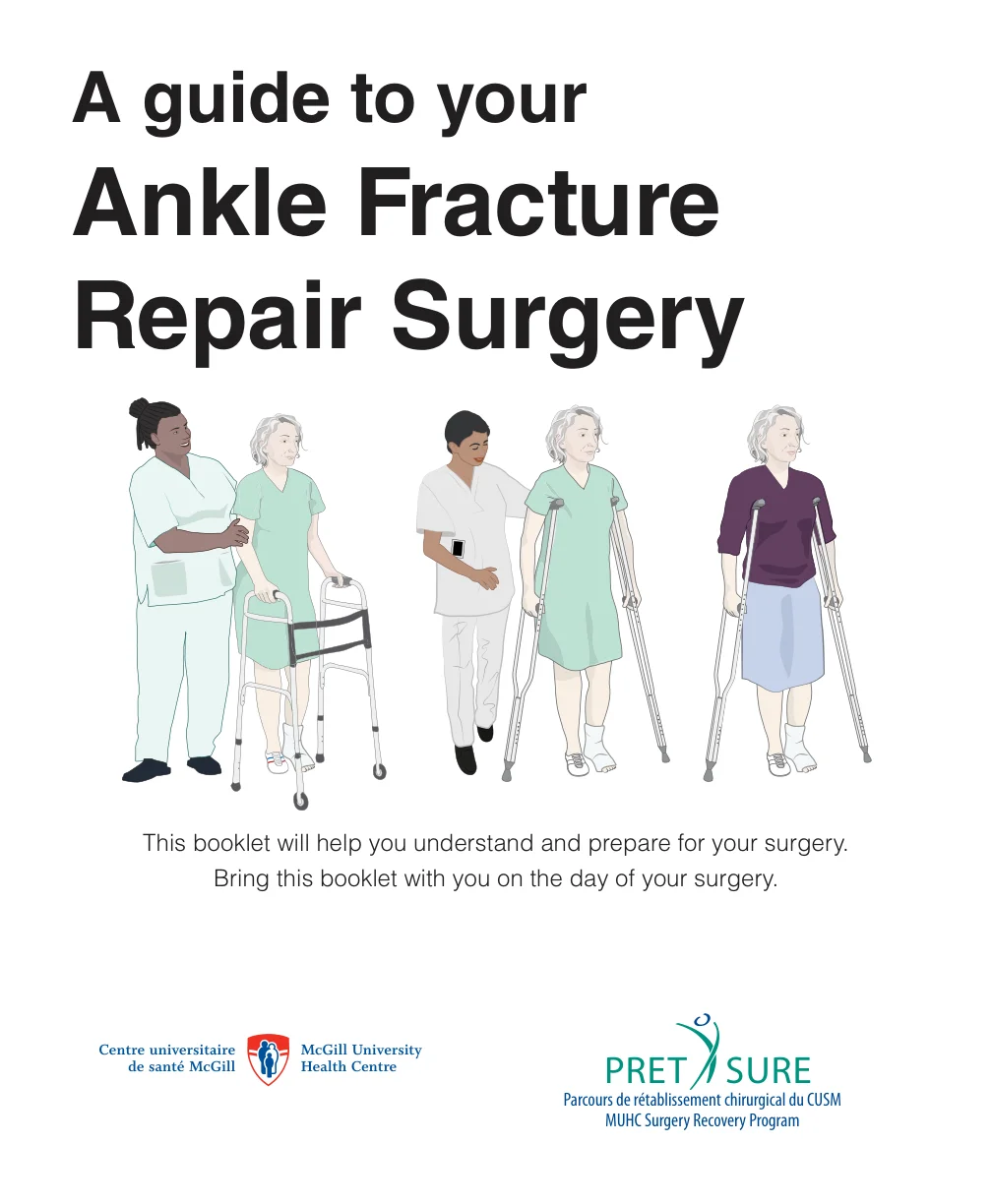A Guide to your Ankle Fracture Repair Surgery