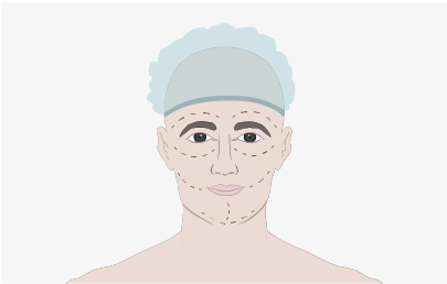 Plastic Surgery